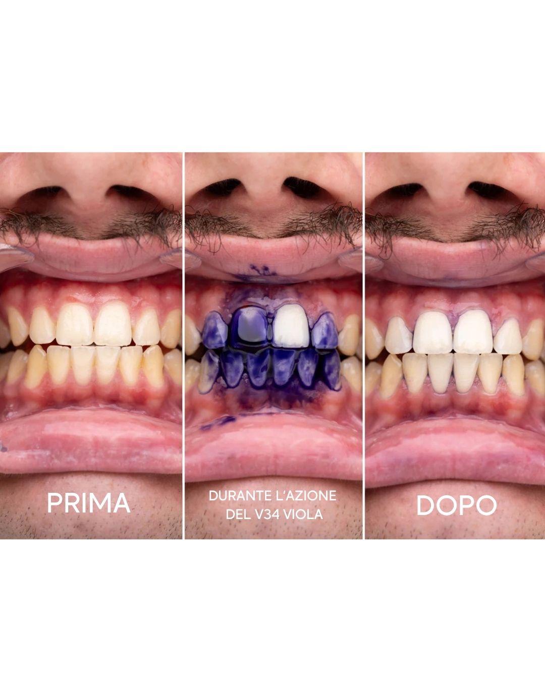 DENTIFRICIO SBIANCANTE